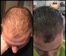 Load image into Gallery viewer, Hair Growth Glaze